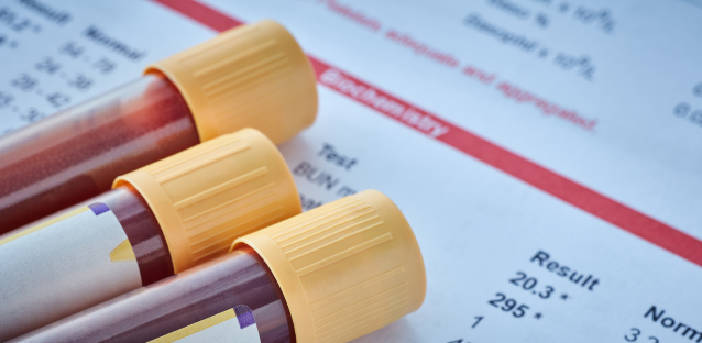 What Is TC In Blood Test?